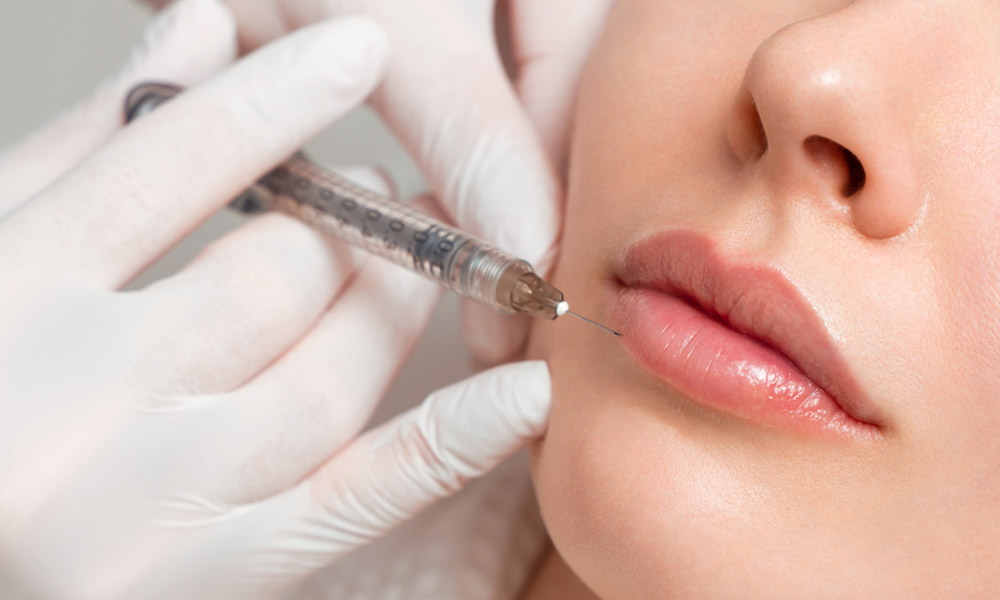 Dermal Fillers